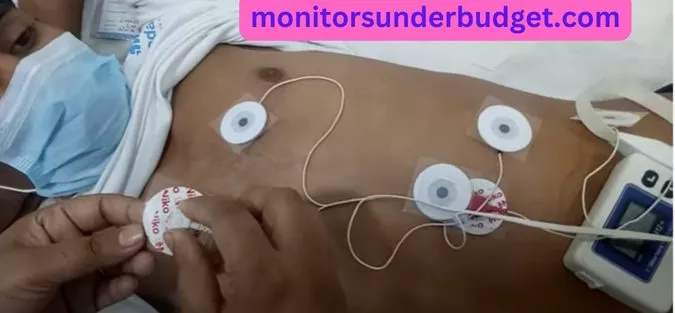 holter monitor wear by man