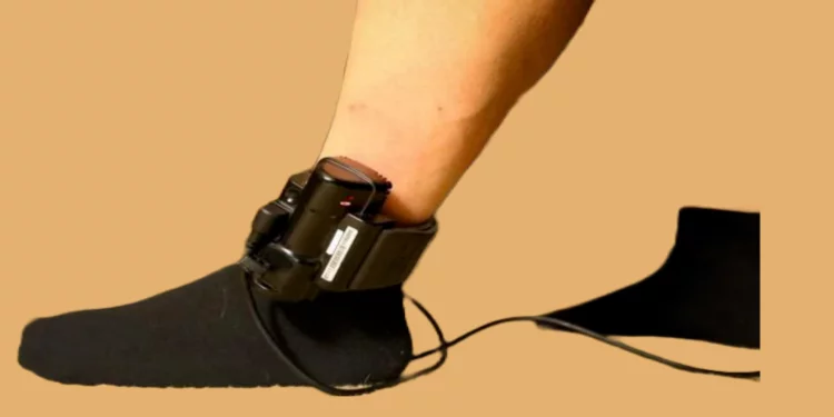 Ankle monitor wear on leg